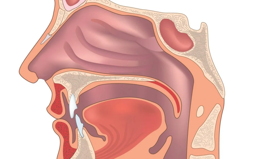 Accent Training in 13 weeks